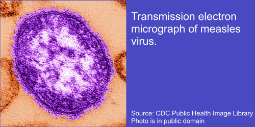 Measles Virus